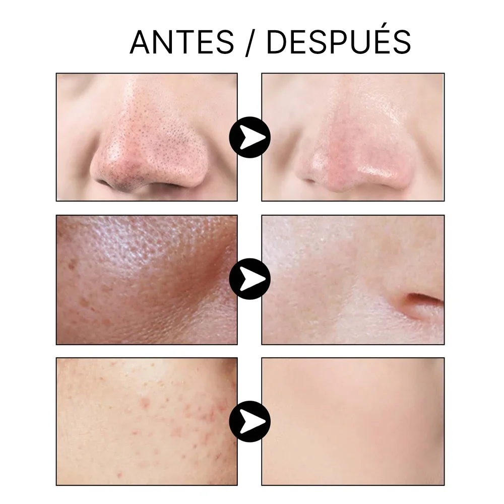 West and Month Mascarilla - Antes y Despues